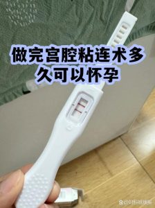 宫颈粘连分离后多久能试孕?医生告诉你最佳备孕时间-两性知识丨两性健康--你想了解的我都知道