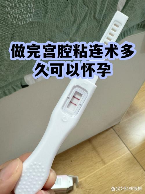 粘连分离后什么时候能试孕