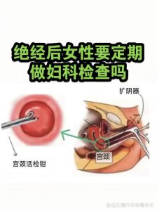 停经后多久查一次妇科?这份复查节奏请收好-两性知识丨两性健康--你想了解的我都知道