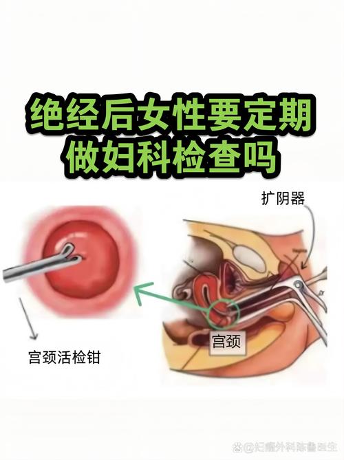 停经后多久查一次妇科
