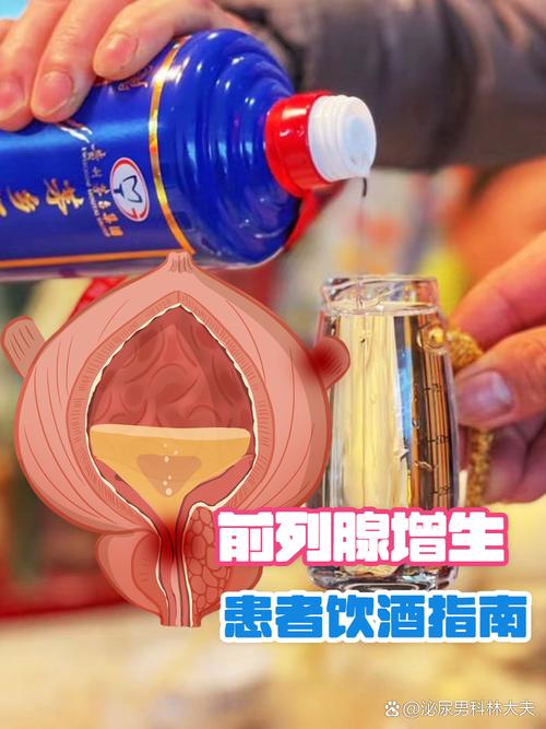 前列腺增生能喝酒吗