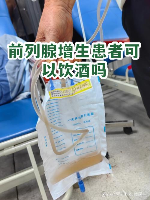 前列腺增生能喝酒吗