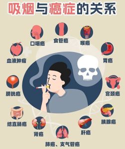 吸烟和乳腺疾病有关吗-两性知识丨两性健康--你想了解的我都知道