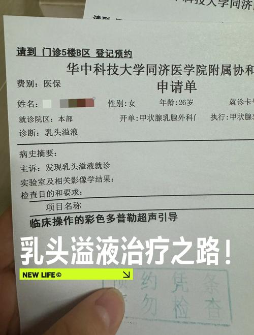 乳头溢液需要进一步检查吗