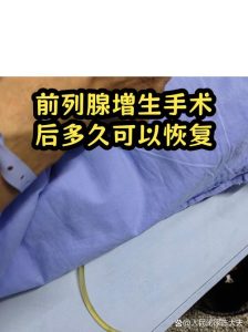 前列腺增生手术要住院几天?一文给你讲清楚-两性知识丨两性健康--你想了解的我都知道