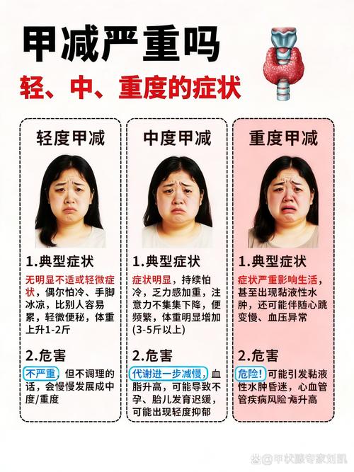 孕期甲减不治疗有什么风险