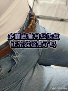 多囊停药后月经会恢复吗?-两性知识丨两性健康--你想了解的我都知道