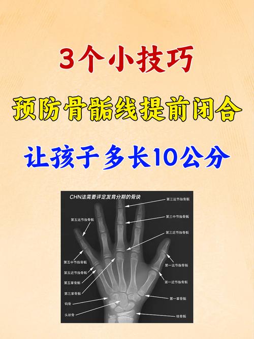 孩子骨龄提前该怎么办