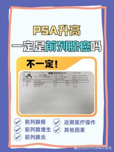 PSA数值高就代表患癌吗-两性知识丨两性健康--你想了解的我都知道
