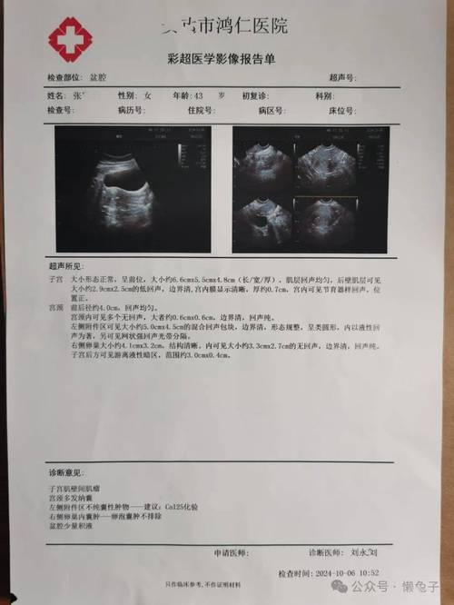 体检报告上的妇科异常哪些可以观察