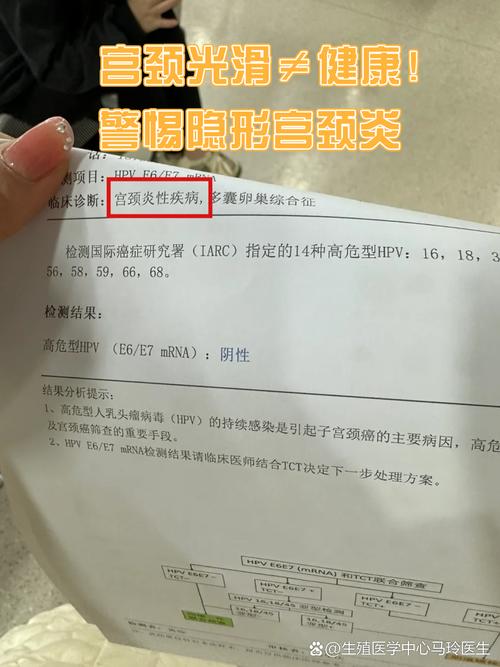 体检报告上的妇科异常哪些可以观察