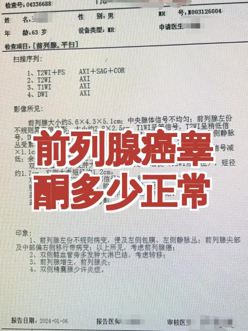 睾酮补充会增加前列腺癌风险吗