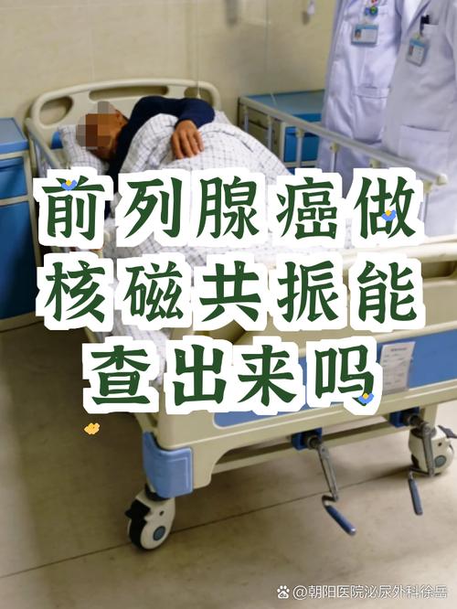 前列腺癌筛查要做核磁吗