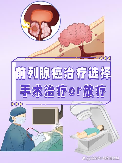 前列腺癌放疗和手术怎么选
