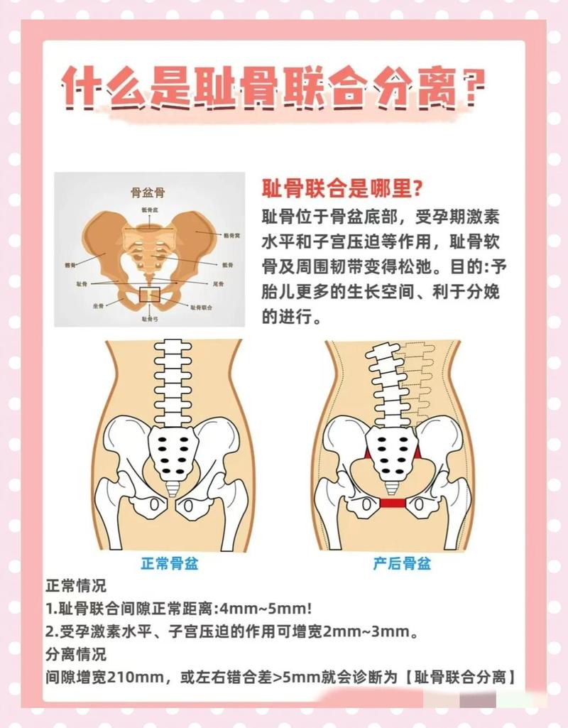性欲低和产后耻骨联合分离有关吗