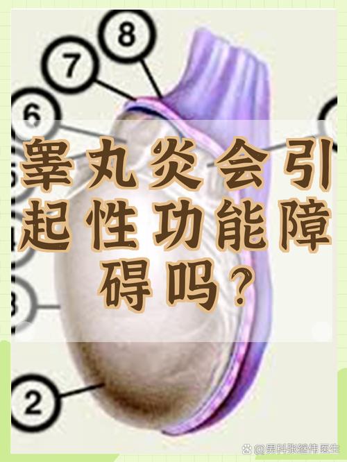 睾丸炎后性欲能恢复吗
