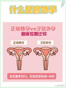 性欲低和宫外孕史有关吗-两性知识丨两性健康--你想了解的我都知道