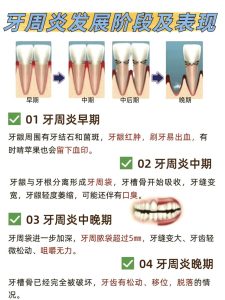 性欲低和慢性牙周炎有关吗？-两性知识丨两性健康--你想了解的我都知道