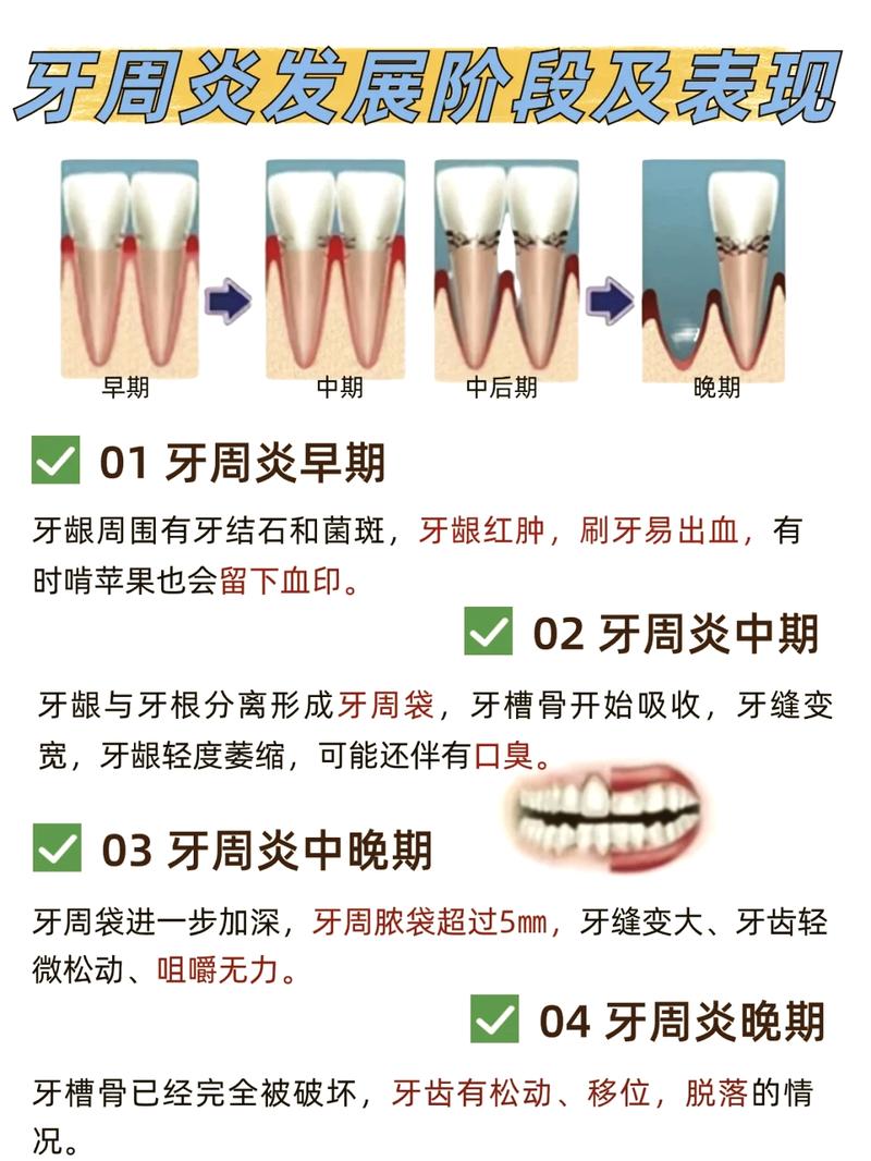 性欲低和慢性牙周炎有关吗