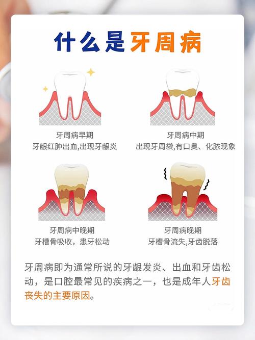 性欲低和慢性牙周炎有关吗
