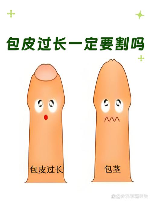 包皮过长什么情况需要手术