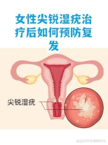 尖锐湿疣治疗后怎么防复发?兔哥分享实用经验-两性知识丨两性健康--你想了解的我都知道