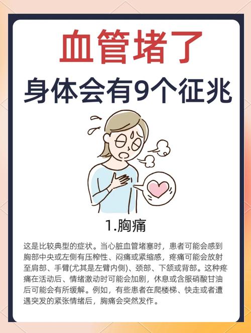 女性心血管病为什么容易漏诊
