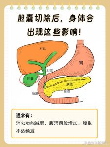 胆囊切除术后性欲会下降吗?真实原因与恢复方法-两性知识丨两性健康--你想了解的我都知道
