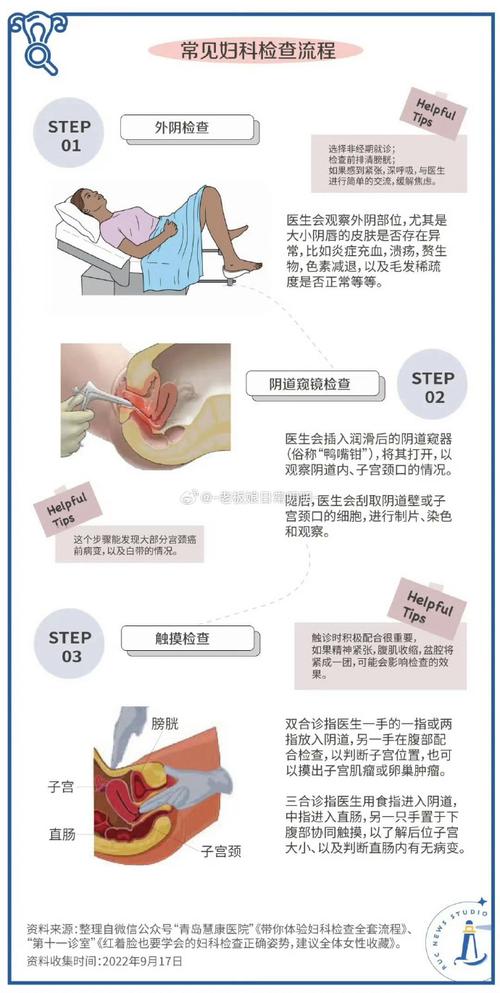 妇科检查怎么保护隐私