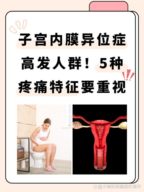 痛经一年比一年重警惕内异症吗