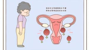 绝经后阴道干涩怎么改善?这6个办法很管用-两性知识丨两性健康--你想了解的我都知道