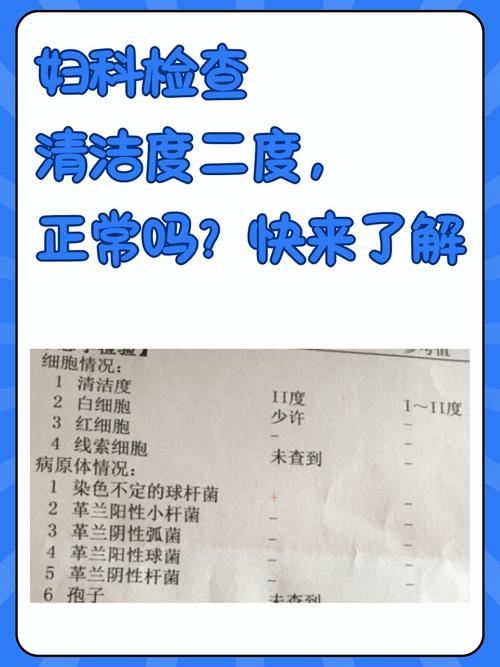 做妇科检查时能要求清场吗-示意图