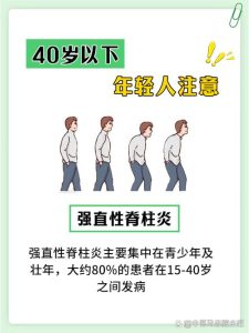 性欲低和强直性脊柱炎有关吗?-两性知识丨两性健康--你想了解的我都知道