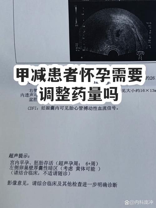 孕期甲减药量要调整吗