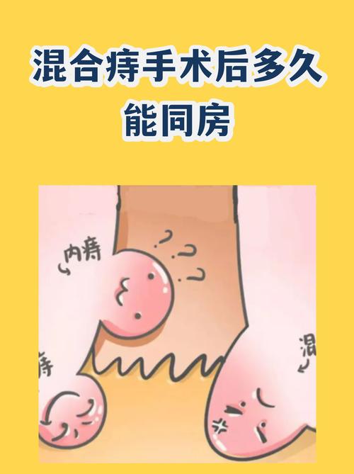 性欲低和痔疮手术后有关吗-示意图
