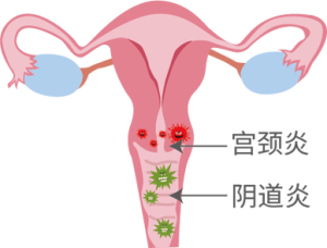 性交疼痛到底要不要做盆腔检查?一文说清楚-两性知识丨两性健康--你想了解的我都知道