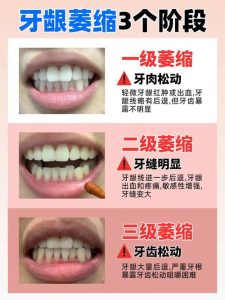 性欲低下伴随牙龈萎缩，背后藏着同一个健康隐患-两性知识丨两性健康--你想了解的我都知道