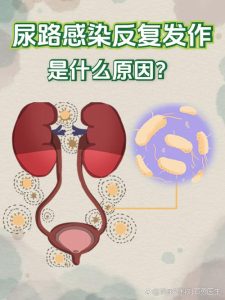 尿路感染为什么总反复?找准原因才能彻底摆脱-两性知识丨两性健康--你想了解的我都知道