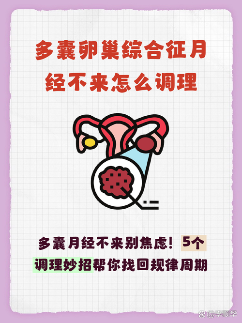 多囊患者月经长期不来怎么管理