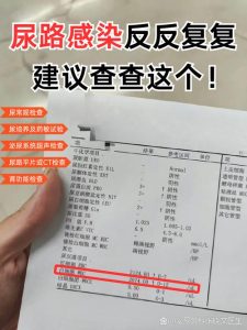 尿路感染反复要查什么？别再只吃消炎药了-两性知识丨两性健康--你想了解的我都知道