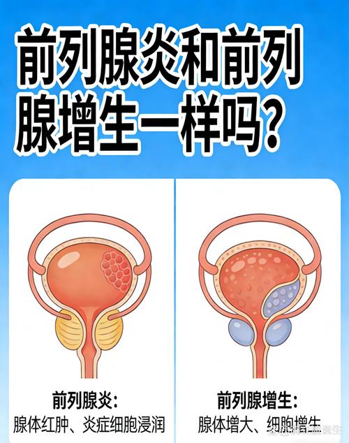 前列腺增生和前列腺炎怎么区分