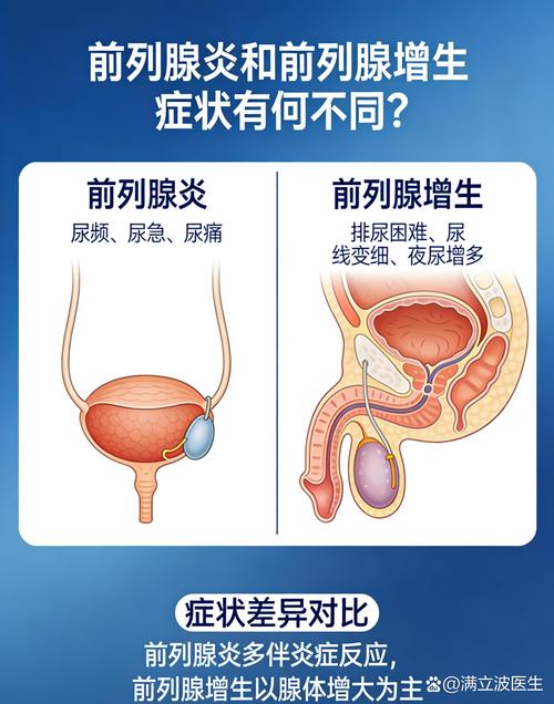 前列腺增生和前列腺炎怎么区分