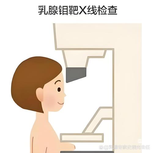 查乳腺该选钼靶还是超声-相关配图