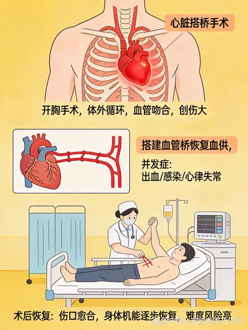 性欲低和心脏搭桥术后有关吗-示意图